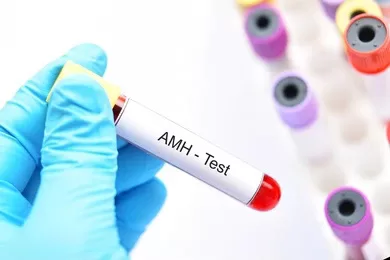 Know your Ovarian Reserve